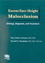 Excess Face Height Malocclusion: Etiology, Diagnosis And Treatment