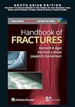 Handbook Of Fracture